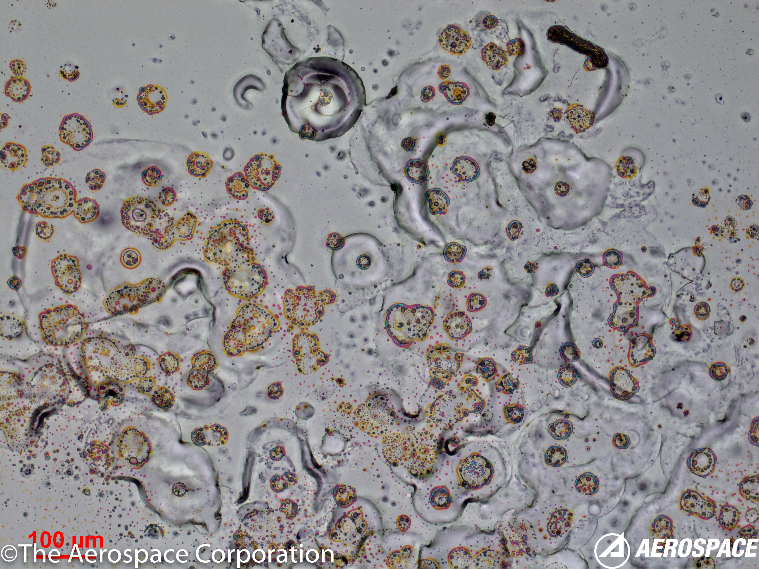 Corrosion Infection